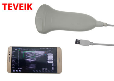 Sonde convexe de scanner d'ultrason de Tablette d'ordinateur portable de machine d'ultrason d'USB de la CE